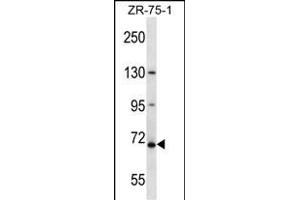 ZN Antibody (N-term ) (ABIN657582 and ABIN2846585) western blot analysis in ZR-75-1 cell line lysates (35 μg/lane). (ZNF135 anticorps  (N-Term))
