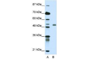 WB Suggested Anti-DEAF1  Antibody Titration: 0. (DEAF1 anticorps  (C-Term))