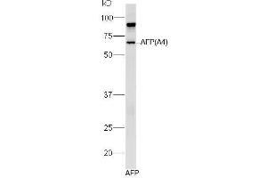 Human AFP lysates probed with Mouse Anti-AFP (A4) Monoclonal Antibody, Unconjugated (bsm-1622M) at 1:300 overnight at 4˚C. (alpha Fetoprotein anticorps)