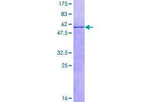 Image no. 1 for Centromere Protein Q (CENPQ) protein (GST tag) (ABIN1349135)