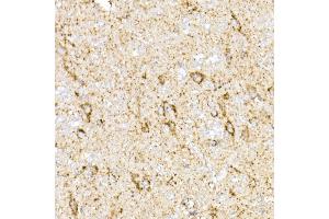 Immunohistochemistry of paraffin-embedded rat brain using MDH2 Rabbit mAb (ABIN7268381) at dilution of 1:25 (40x lens). (MDH2 anticorps)