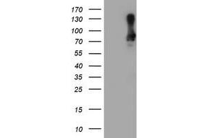Western Blotting (WB) image for anti-SAM Domain and HD Domain 1 (SAMHD1) antibody (ABIN1500798) (SAMHD1 anticorps)