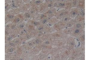 Detection of BMP9 in Human Liver Tissue using Polyclonal Antibody to Bone Morphogenetic Protein 9 (BMP9) (GDF2 anticorps  (AA 32-427))