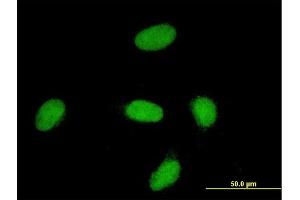 Immunofluorescence of monoclonal antibody to YAP1 on HeLa cell. (YAP1 anticorps  (AA 53-161))