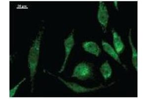 anti-MOB Kinase Activator 2 (MOB2) antibody