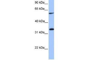 WB Suggested Anti-TSKS Antibody Titration: 0. (TSKS anticorps  (Middle Region))