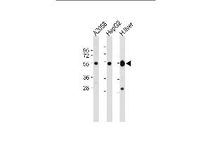 All lanes : Anti-UGP2 Antibody (C-term) at 1:2000 dilution Lane 1:  whole cell lysate Lane 2: HepG2 whole cell lysate Lane 3: Human liver lysate Lysates/proteins at 20 μg per lane. (UGP2 anticorps  (C-Term))