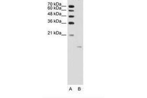 Image no. 2 for anti-Acid Phosphatase 1, Soluble (ACP1) (AA 21-70) antibody (ABIN203506)