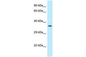 Image no. 1 for anti-Aminolevulinate Dehydratase (ALAD) (N-Term) antibody (ABIN6747869) (ALAD anticorps  (N-Term))
