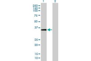 Western Blot analysis of AKTIP expression in transfected 293T cell line by AKTIP MaxPab polyclonal antibody. (AKTIP anticorps  (AA 1-292))