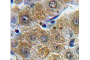 Used in DAB staining on fromalin fixed paraffin-embedded Liver tissue (ORM1 anticorps  (AA 19-201))