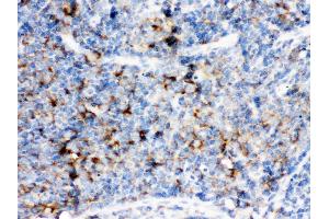 CD14 was detected in paraffin-embedded sections of rat lymphaden tissues using rabbit anti- CD14 Antigen Affinity purified polyclonal antibody at 1 μg/mL.