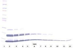 Image no. 3 for anti-Chemokine (C-X-C Motif) Ligand 16 (CXCL16) antibody (ABIN465413)