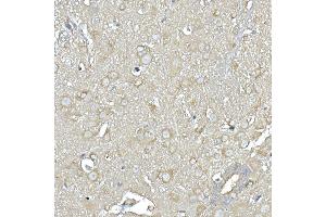 Immunohistochemistry of paraffin-embedded mouse spinal cord using IL11RA Rabbit mAb (ABIN7267984) at dilution of 1:150 (40x lens). (IL11RA anticorps)