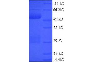 SDS-PAGE (SDS) image for ERG, ETS transcription factor (ERG) (AA 1-486), (full length) protein (His tag) (ABIN5713436)