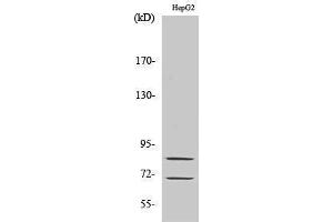 Western Blotting (WB) image for anti-Choline O-Acetyltransferase (CHAT) (Internal Region) antibody (ABIN3183908) (Choline Acetyltransferase anticorps  (Internal Region))