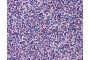 anti-Promyelocytic Leukemia (PML) (C-Term) antibody