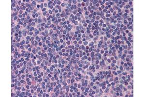 Immunohistochemistry (IHC) image for anti-Promyelocytic Leukemia (PML) (C-Term) antibody (ABIN2777721) (PML anticorps  (C-Term))