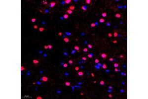 Immunofluorescence of paraffin embedded rat brain using TCEAL3 (ABIN7075951) at dilution of 1:700 (400x lens)