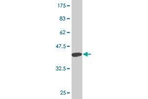 Western Blot detection against Immunogen (37. (ARHGAP6 anticorps  (AA 531-636))