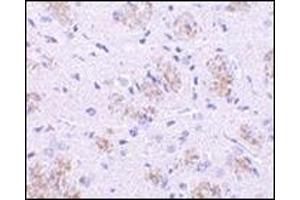 Immunohistochemistry of KLHL1 in rat brain tissue with this product at 10 μg/ml. (KLHL1 anticorps  (N-Term))