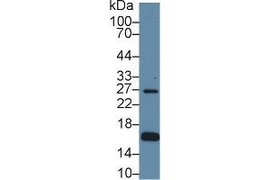 Detection of AQP2 in Human Hela cell lysate using Polyclonal Antibody to Aquaporin 2, Collecting Duct (AQP2)