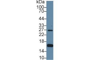 Detection of AQP2 in Human Hela cell lysate using Polyclonal Antibody to Aquaporin 2, Collecting Duct (AQP2) (AQP2 anticorps  (AA 177-271))