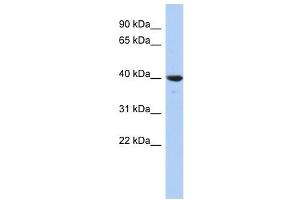 GLRX3 antibody used at 1 ug/ml to detect target protein. (GLRX3 anticorps  (N-Term))