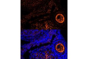 Immunofluorescence analysis of mouse oophoroma cells using ZP2 antibody (ABIN6128965, ABIN6150534, ABIN6150535 and ABIN6214263) at dilution of 1:100.