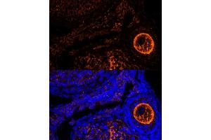 Immunofluorescence analysis of mouse oophoroma cells using ZP2 antibody (ABIN6128965, ABIN6150534, ABIN6150535 and ABIN6214263) at dilution of 1:100. (ZP2 anticorps  (AA 651-745))