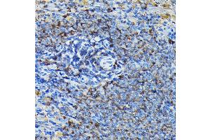 Immunohistochemistry of paraffin-embedded mouse spleen using RPL23A Rabbit pAb (ABIN1682576, ABIN3018519, ABIN3018520 and ABIN6220494) at dilution of 1:100 (40x lens).