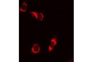 ABIN6267680 staining 293 cells by IF/ICC. (BAD anticorps  (pSer155))
