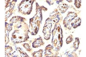 IHC testing of FFPE human placenta with Podocalyxin antibody