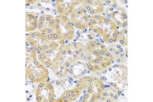 Immunohistochemistry of paraffin-embedded mouse kidney using CCDC124 antibody  at dilution of 1:100 (40x lens). (CCDC124 anticorps  (AA 1-223))