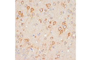 Immunohistochemistry of paraffin-embedded mouse brain using GluR1/GRI Rabbit pAb (826) at dilution of 1:100 (40x lens).