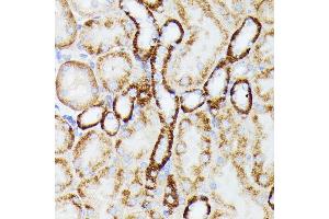 Immunohistochemistry of paraffin-embedded mouse kidney using MT-ND5 antibody (ABIN7268603) at dilution of 1:100 (40x lens).
