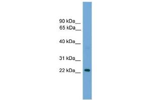WB Suggested Anti-RAB39 Antibody Titration: 0. (RAB39 anticorps  (N-Term))