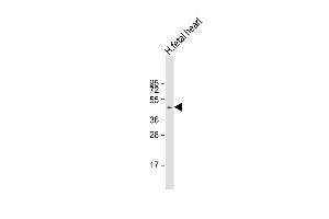Anti-ZDHHC18 Antibody (C-Term) at 1:1000 dilution + human fetal heart lysate Lysates/proteins at 20 μg per lane.