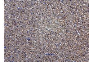 IHC analysis of Hexokinase 1/HK1 using anti-Hexokinase 1/HK1 antibody (ABIN7600260). (Hexokinase 1 anticorps  (AA 17-323))