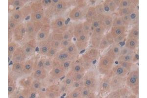 Detection of AFP in Human Liver Tissue using Polyclonal Antibody to Alpha-Fetoprotein (AFP)