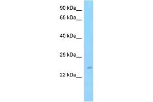 WB Suggested Anti-Slc9a3r2 Antibody Titration: 1.