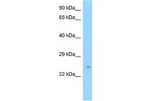 WB Suggested Anti-Slc9a3r2 Antibody Titration: 1. (SLC9A3R2 anticorps  (C-Term))