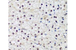 Immunohistochemistry of paraffin-embedded Human liver using DNMT1 Polyclonal Antibody at dilution of 1:200 (40x lens). (DNMT1 anticorps)