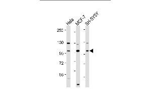 All lanes : Anti-VAV2 Antibody (N-Term) at 1:2000 dilution Lane 1: Hela whole cell lysate Lane 2: MCF-7 whole cell lysate Lane 3: SH-SY5Y whole cell lysate Lysates/proteins at 20 μg per lane.