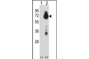Western blot analysis of BIRC3 (arrow) using rabbit polyclonal BIRC3 Antibody (N-term) (ABIN657941 and ABIN2846885).