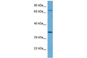 Host:  Rabbit  Target Name:  TSPAN5  Sample Tissue:  Human 293T Whole Cell  Antibody Dilution:  1ug/ml