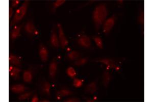 Immunofluorescence analysis of U2OS cells using PCCB antibody (ABIN5973142). (PCCB anticorps)