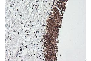 Image no. 3 for anti-RIO Kinase 2 (RIOK2) (AA 277-552) antibody (ABIN1491305) (RIOK2 anticorps  (AA 277-552))