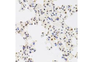 Immunohistochemistry of paraffin-embedded rat lung using RPS6KA3 antibody (ABIN1876624) at dilution of 1:100 (40x lens).