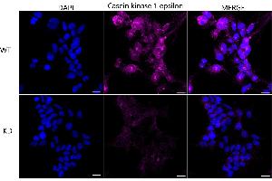 anti-Casein Kinase 1, epsilon (CSNK1E) antibody
